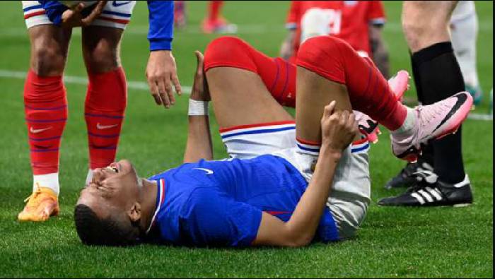 Kylian Mbappe d&iacute;nh chấn thương trước thềm Euro 2024