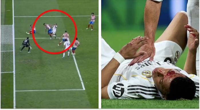 Mbappe đổ m&aacute;u, Real Madrid bức x&uacute;c v&igrave; mất phạt đền