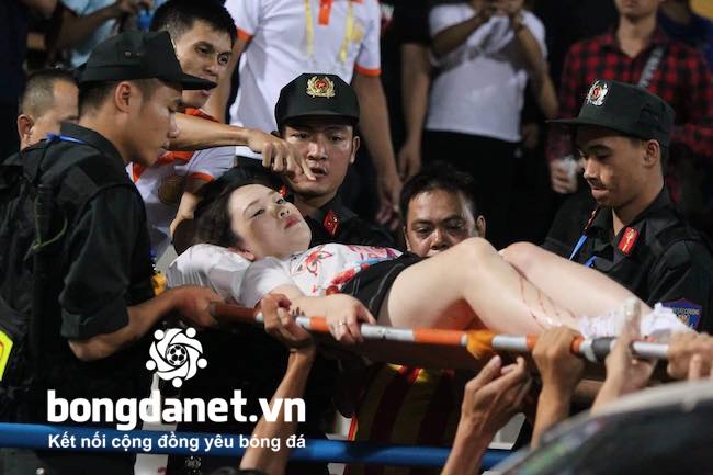 CĐV nữ bị tr&uacute;ng ph&aacute;o s&aacute;ng được chi trả to&agrave;n bộ viện ph&iacute;