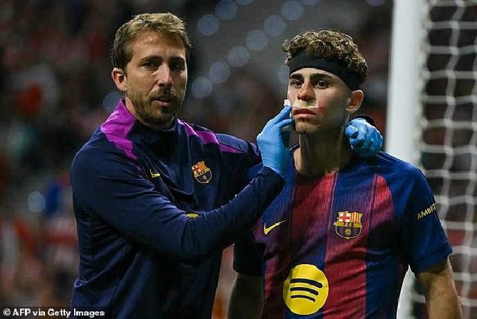 Cầu thủ Barcelona đổ m&aacute;u v&igrave; bị đối thủ đạp gi&agrave;y v&agrave;o mặt